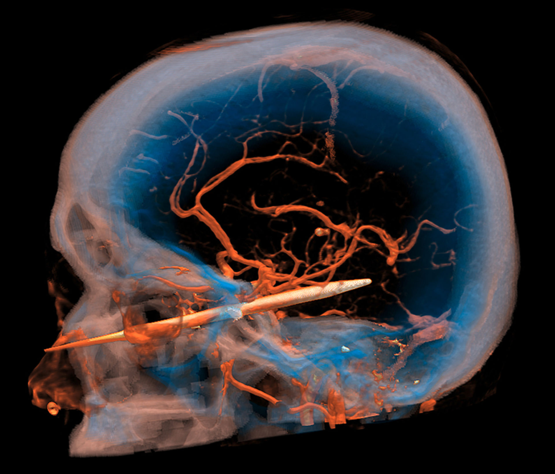 Third contest for computed tomography images – 