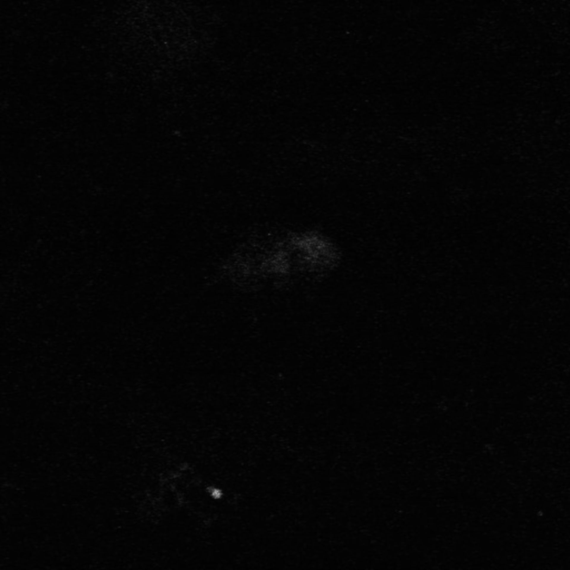 Xenopus laevis (Neuronal cell body) - CIL:37065