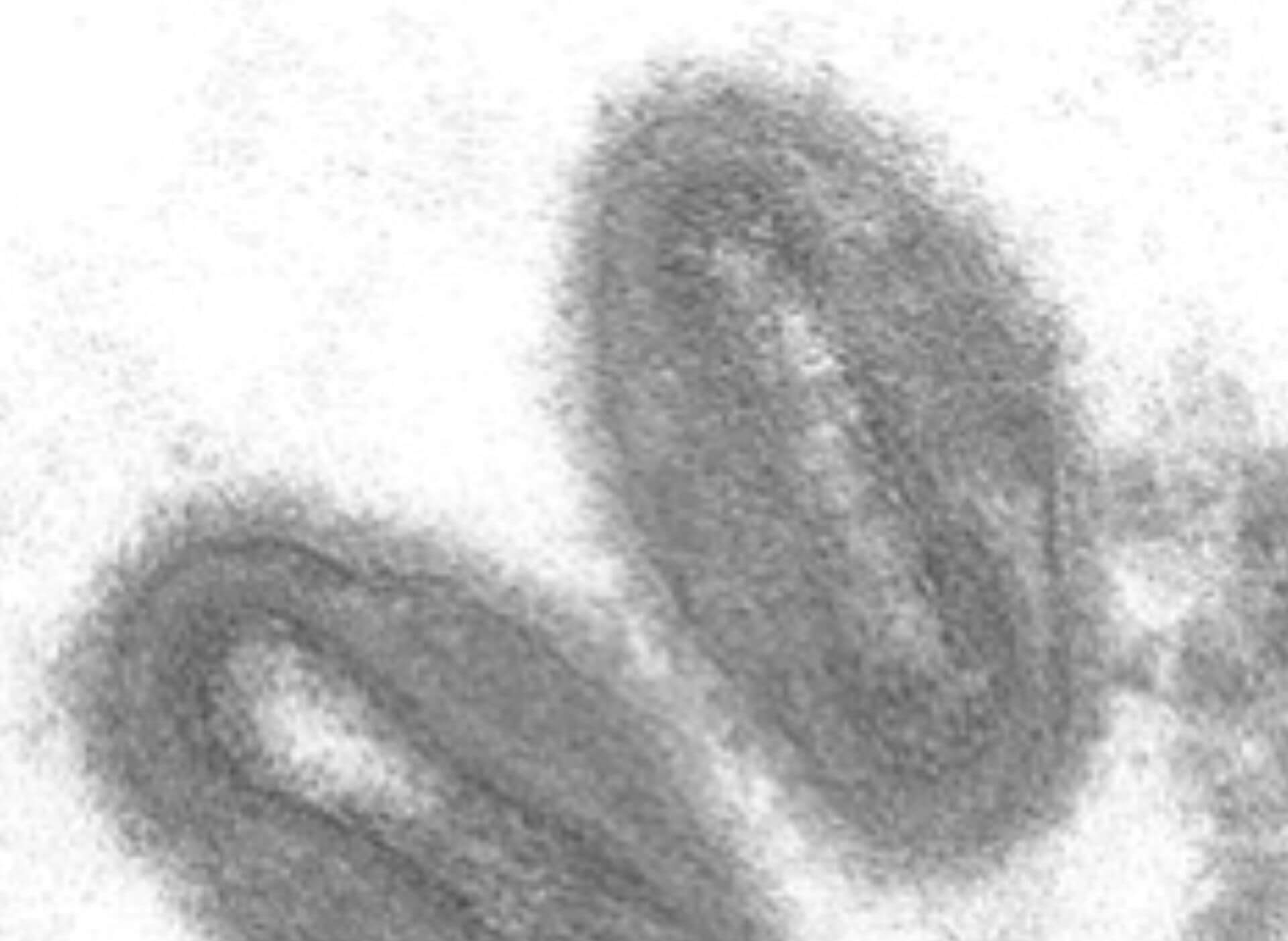 Affenpockenvirus