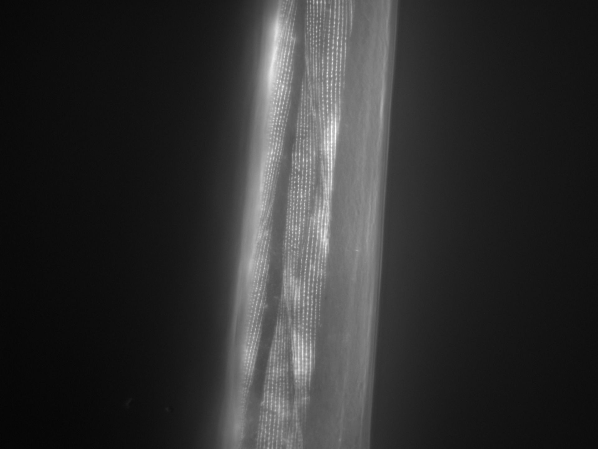 Caenorhabditis elegans (Actin filament) - CIL:1025