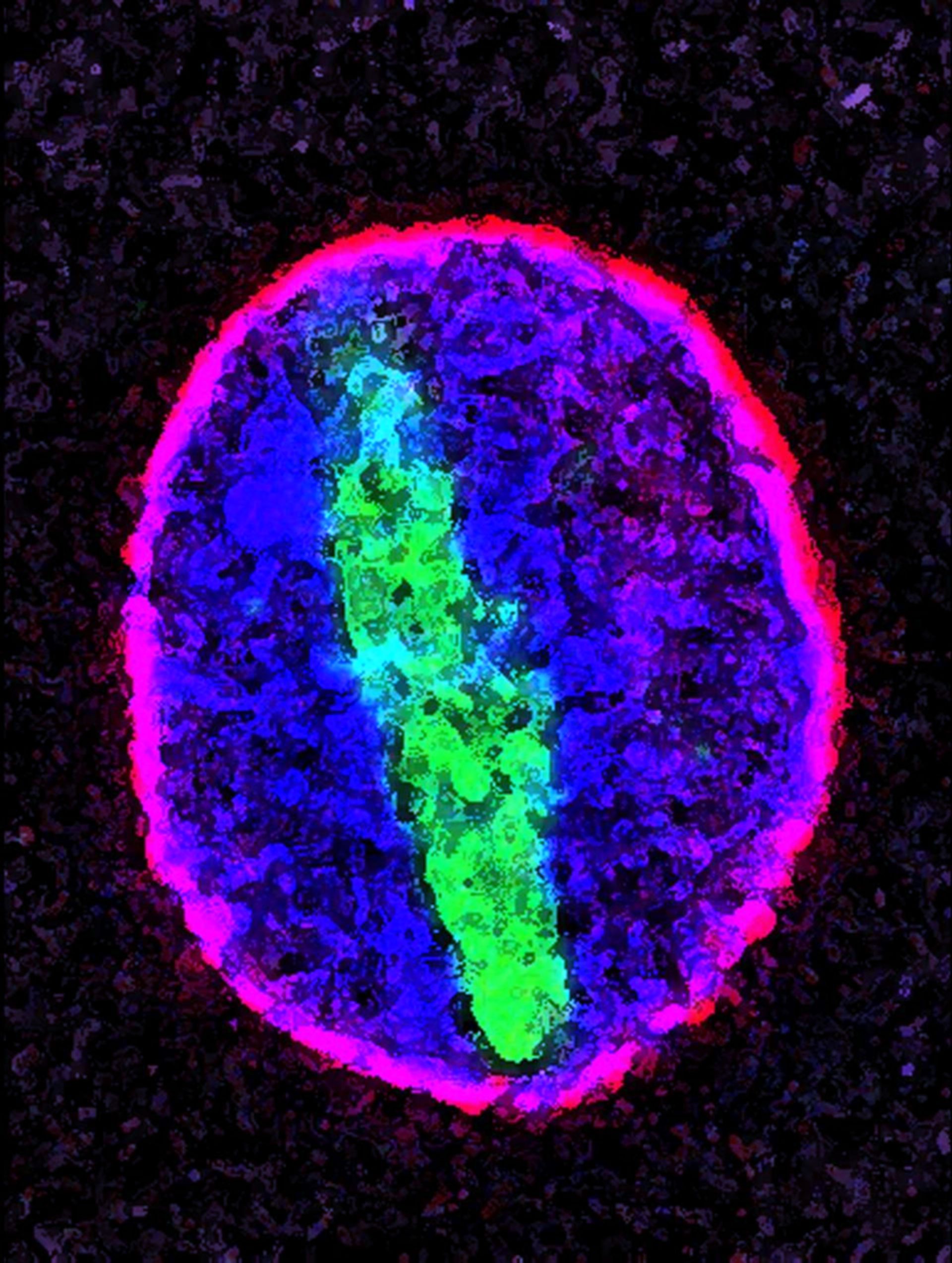 Rattus norvegicus (Nuclear envelope) - CIL:168