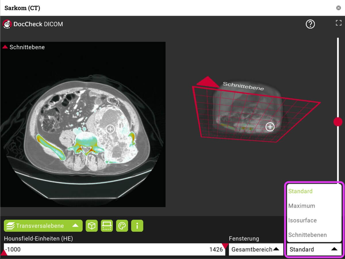 DICOM-Viewer 8