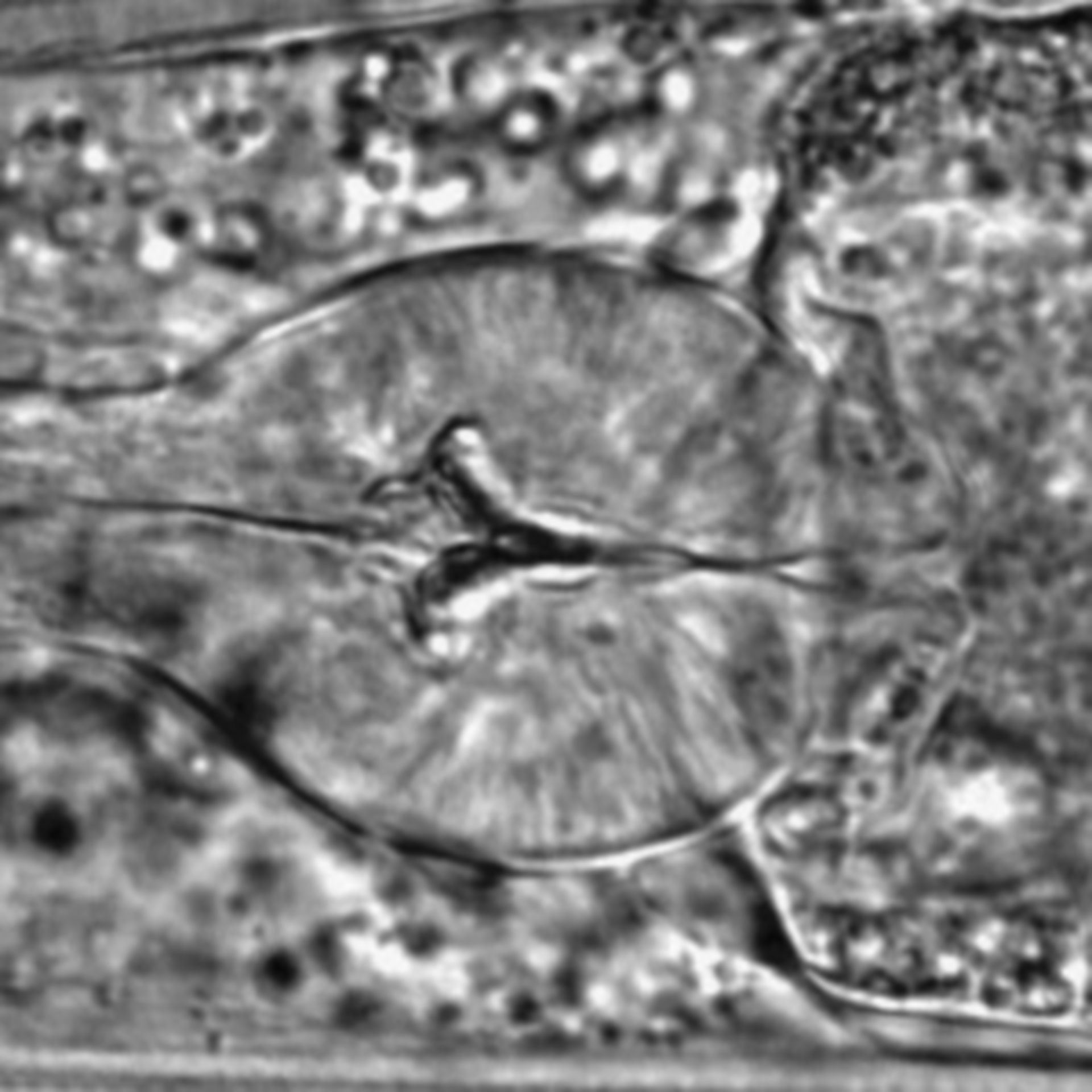 Caenorhabditis elegans - CIL:1615