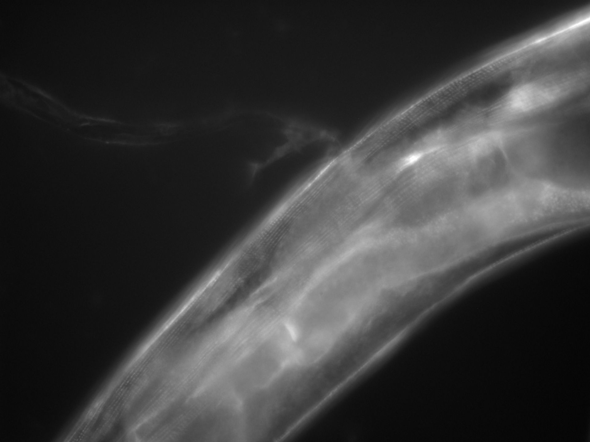 Caenorhabditis elegans (Actin filament) - CIL:1131