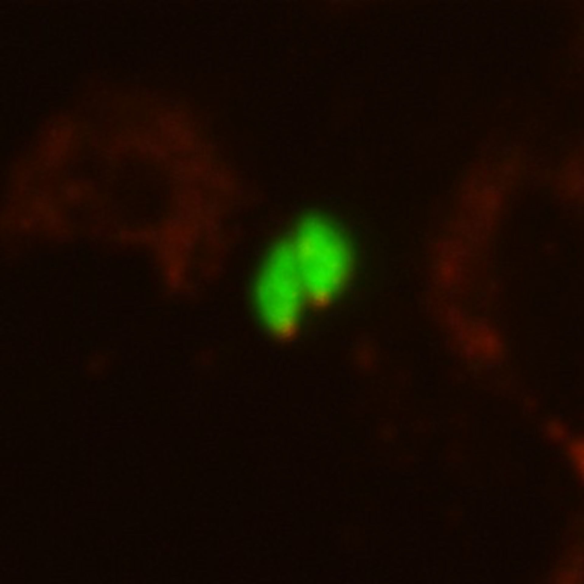 Toxoplasma gondii RH (Microtubule organizing center) - CIL:10454