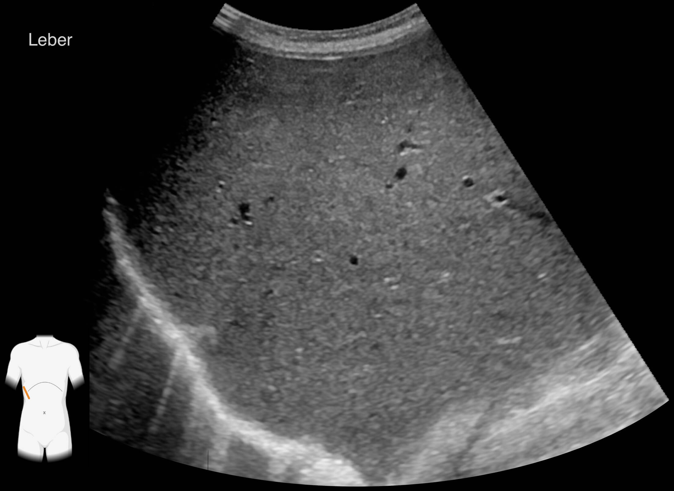 leber_fin_original.jpg