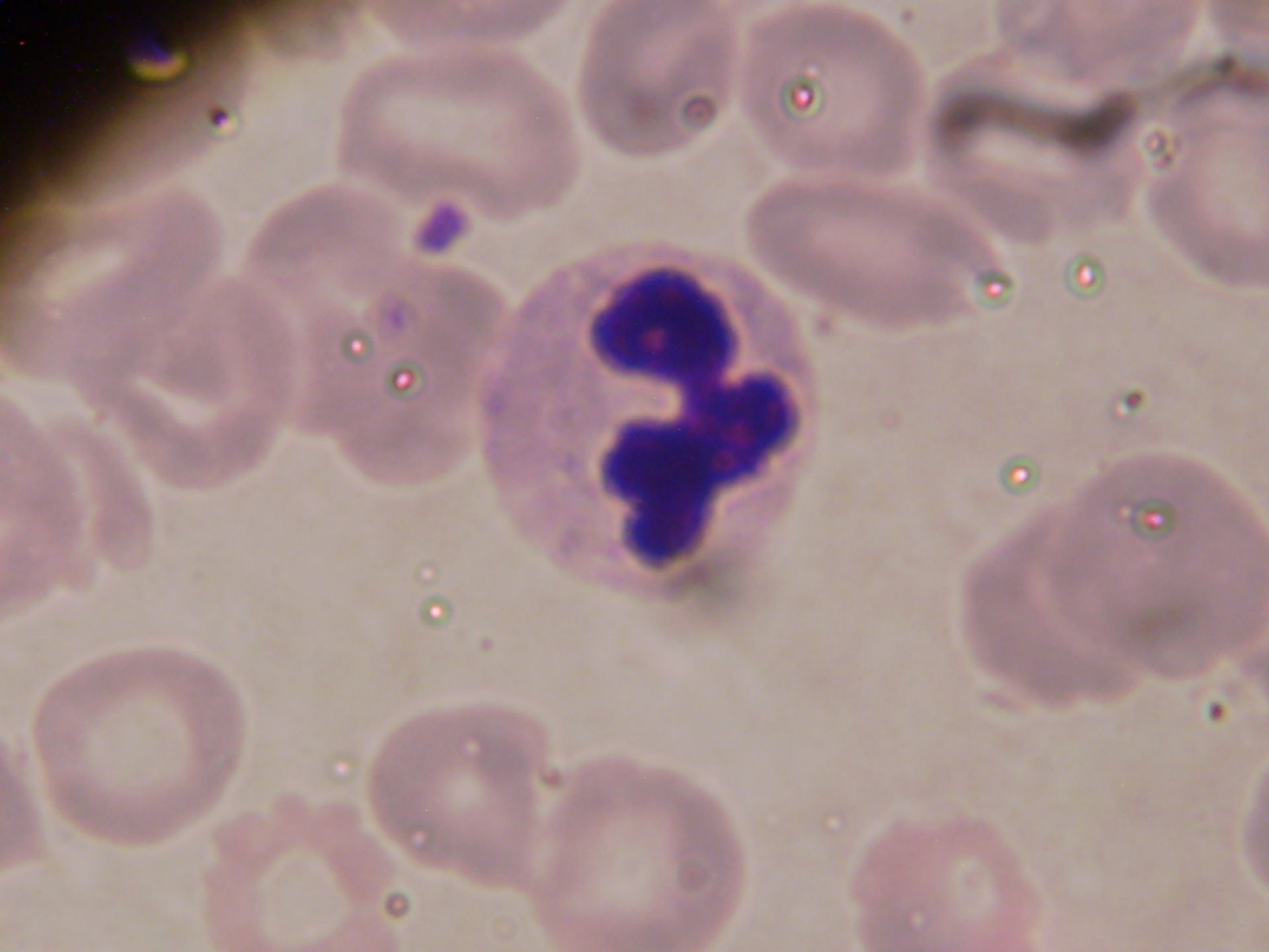 Plasmodium a forma di nastro