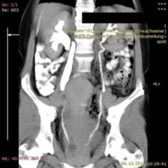 Uterus - DocCheck Flexikon