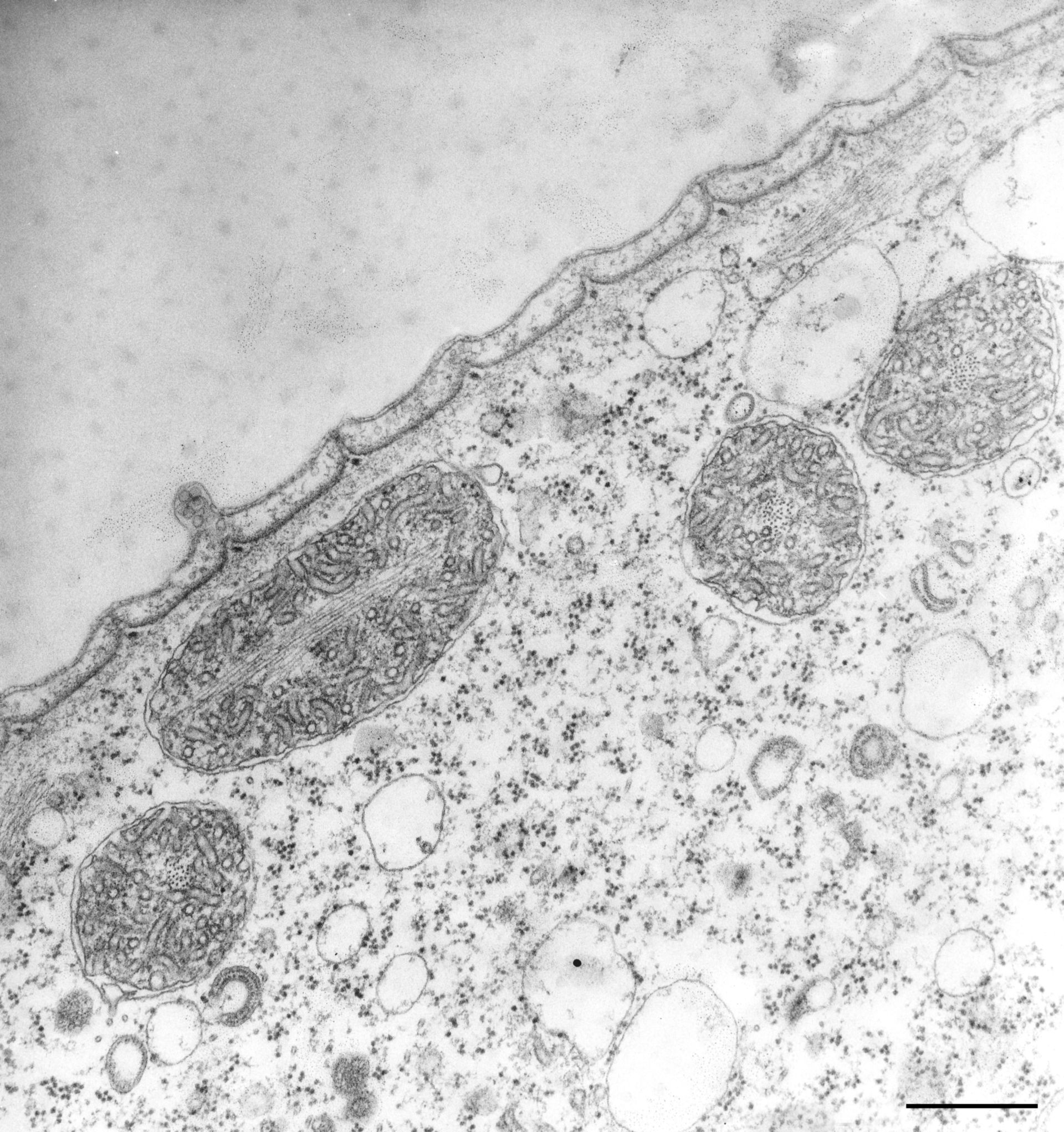 Vorticella convallaria (Mitochondrial chromosome) - CIL:36259