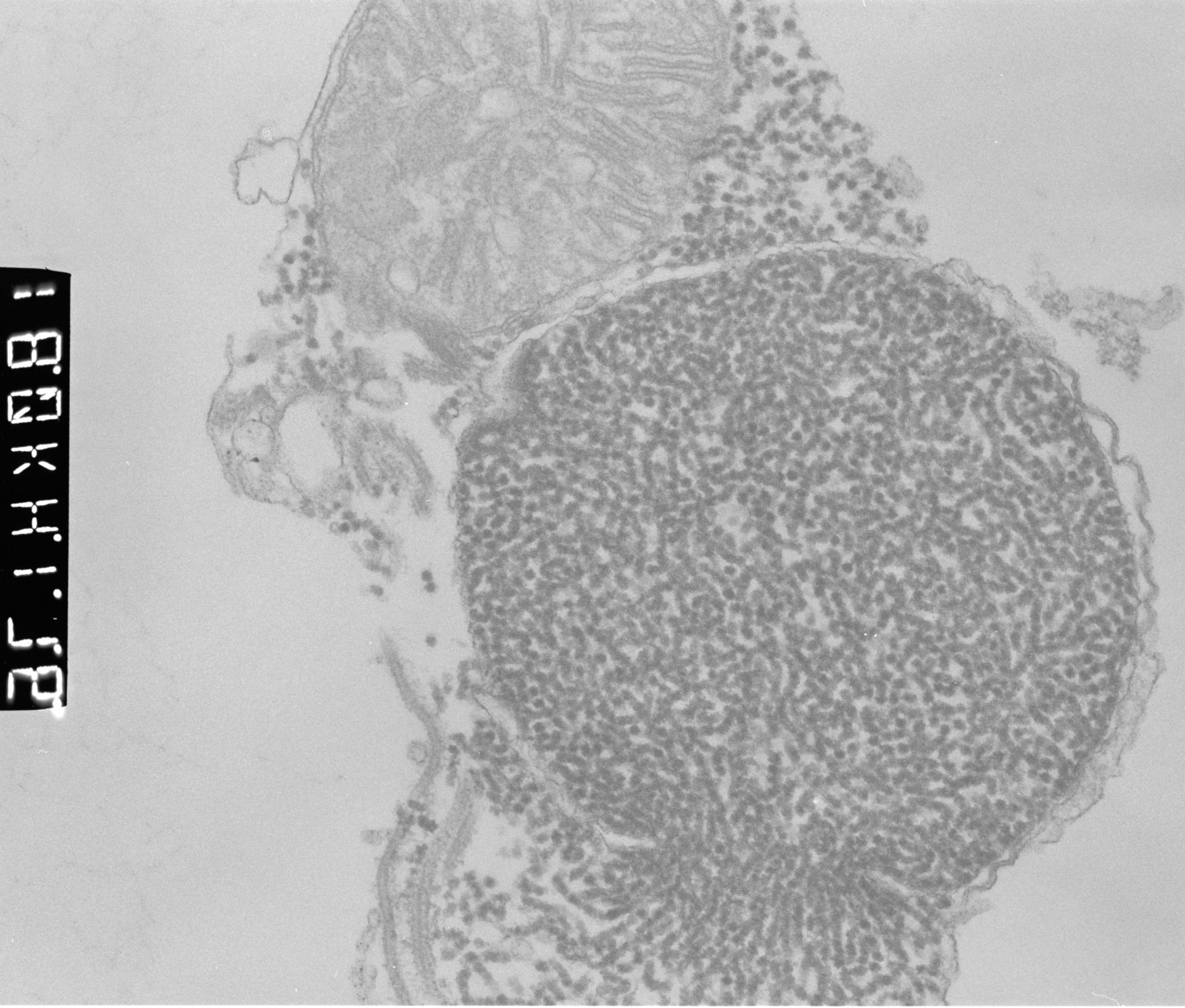 Patiria miniata (Male germ cell nucleus) - CIL:449