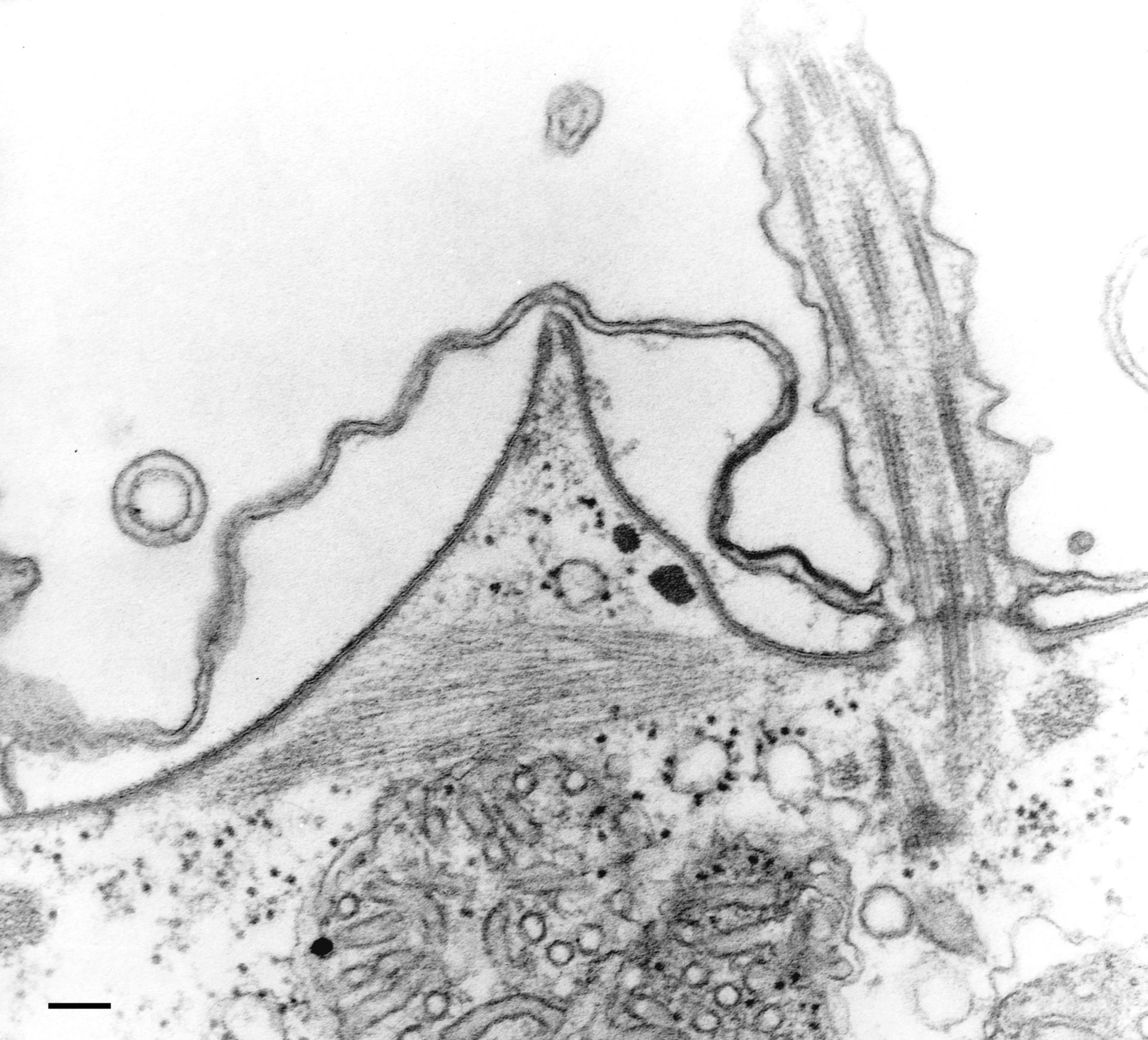Paramecium multimicronucleatum (Cell cortex) - CIL:36597
