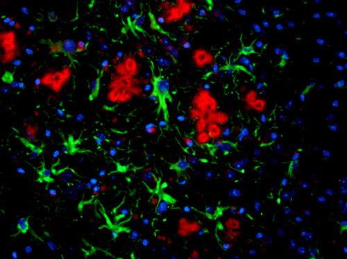 Das Foto zeigt einen gefärbten Dünnschnitt eines Mausgehirns: ß-Amyloid Peptid (rot), Astrozyten (grün) und die Kerne der Nervenzellen (blau). © Abteilung für Neurologie/Universität Bonn