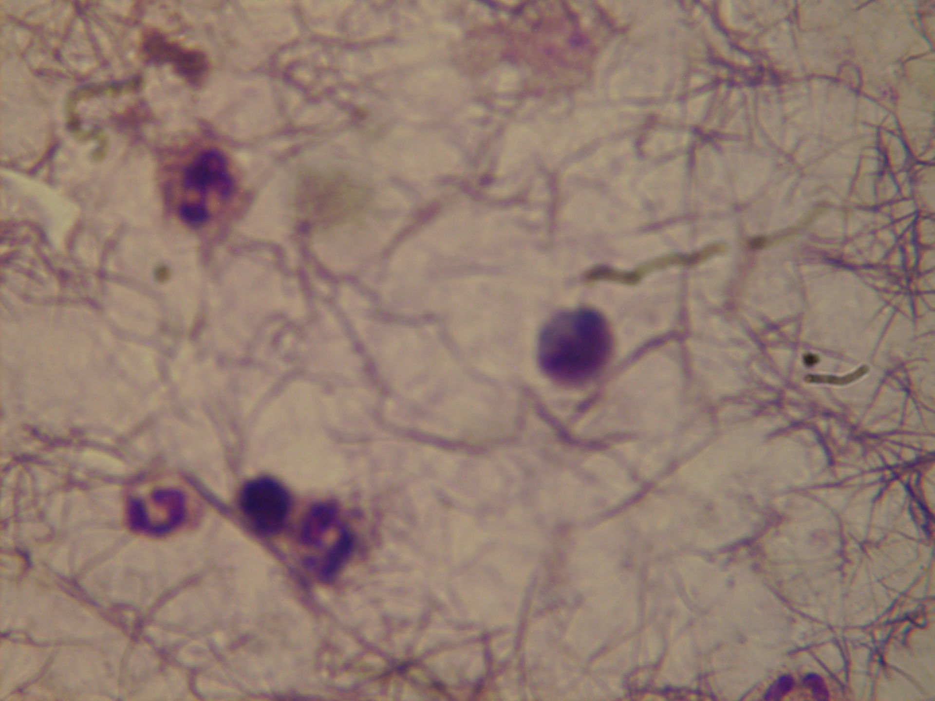 Plasmodium ovale: Schüffeler Tüpfelung