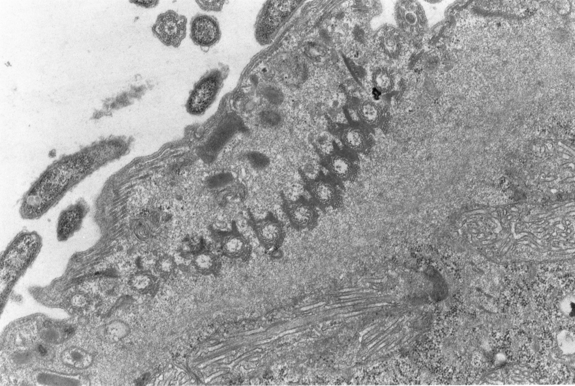 Didinium nasutum (Bacterial ectosymbiont) - CIL:4663