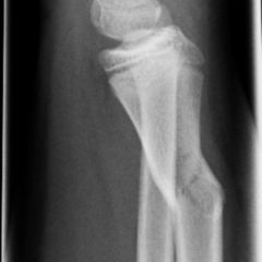 Radius DocCheck Flexikon