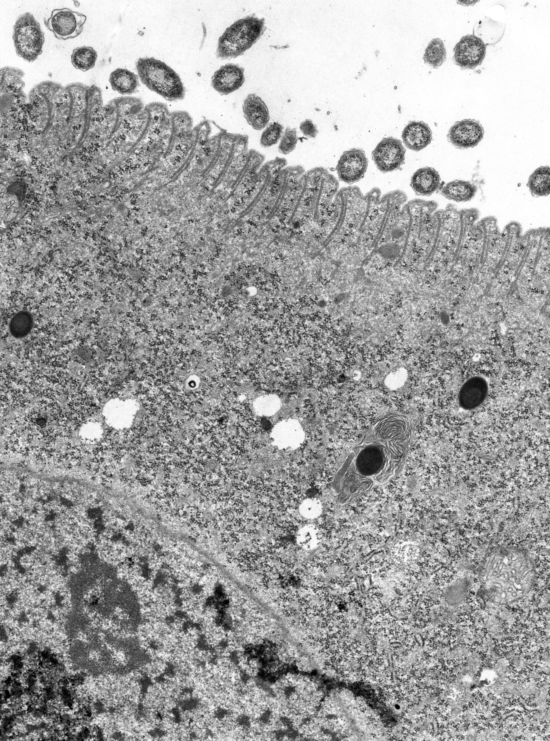 Didinium nasutum (Extrusomes) - CIL:38864