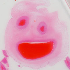 Nabelschnur DocCheck Flexikon