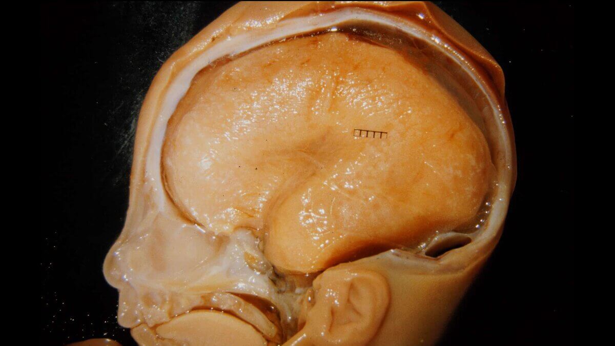 Gehirn eines Fetus