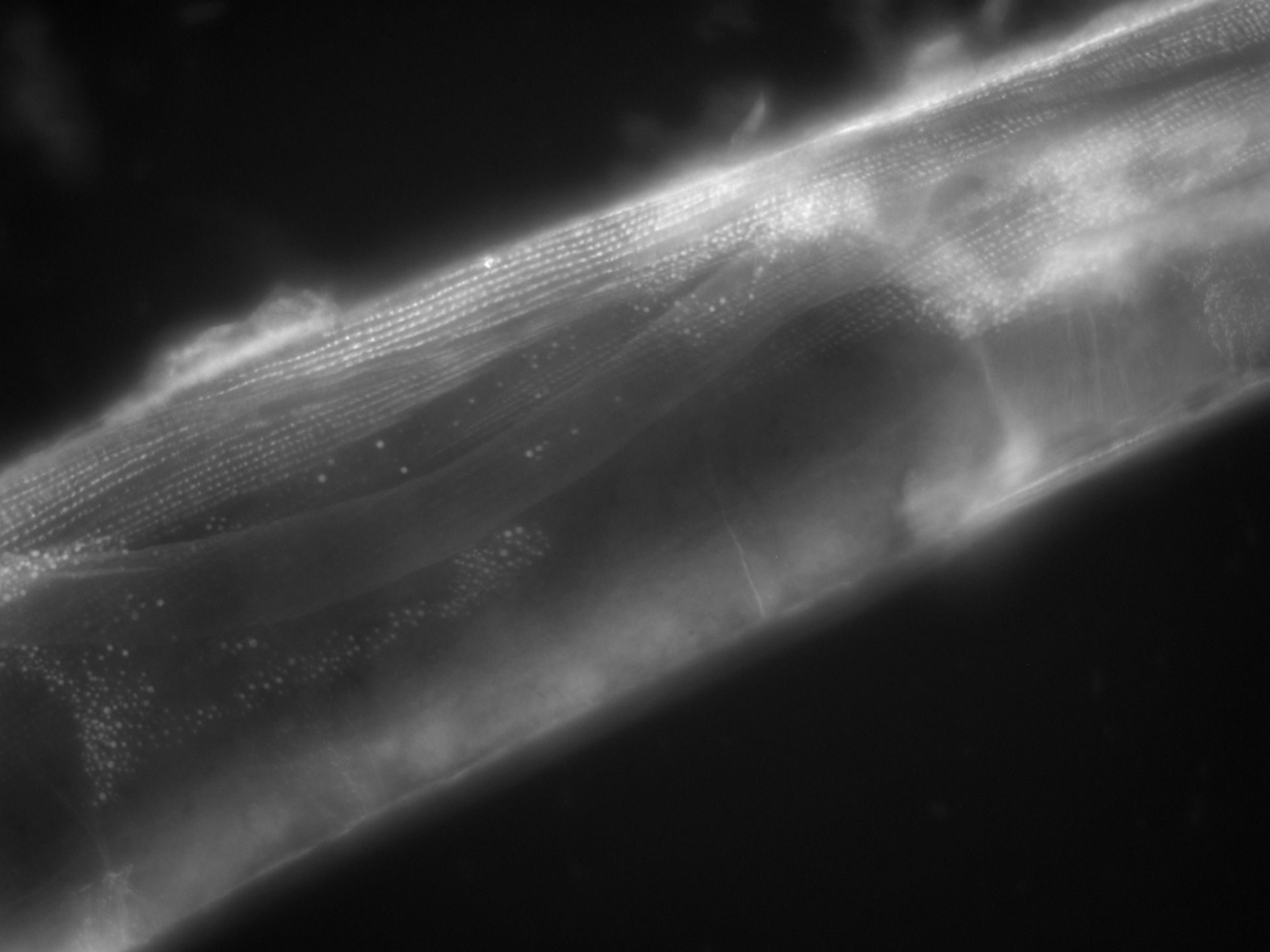 Caenorhabditis elegans (Actin filament) - CIL:1121