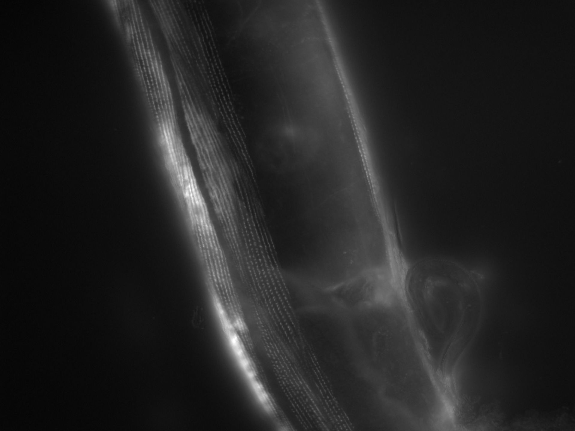 Caenorhabditis elegans (Actin filament) - CIL:1191