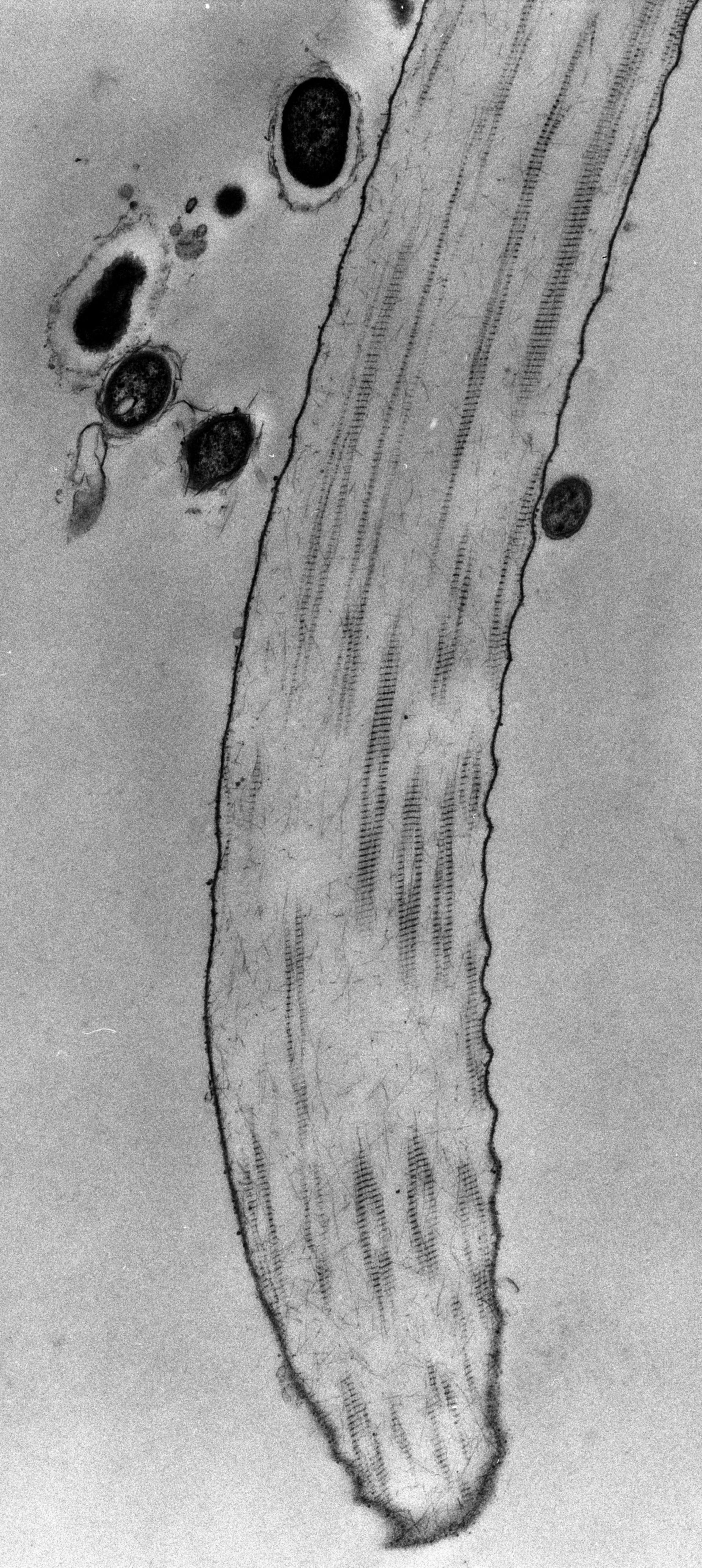 Opercularia coarctata (Fibril) - CIL:39169