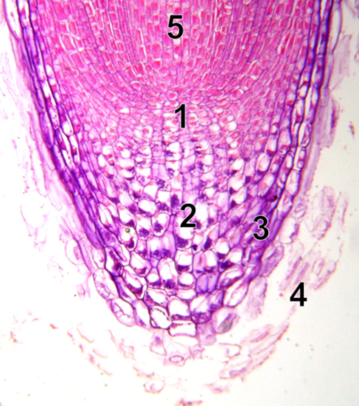 Kormophyt: Wurzelspitze (mikroskopisch)