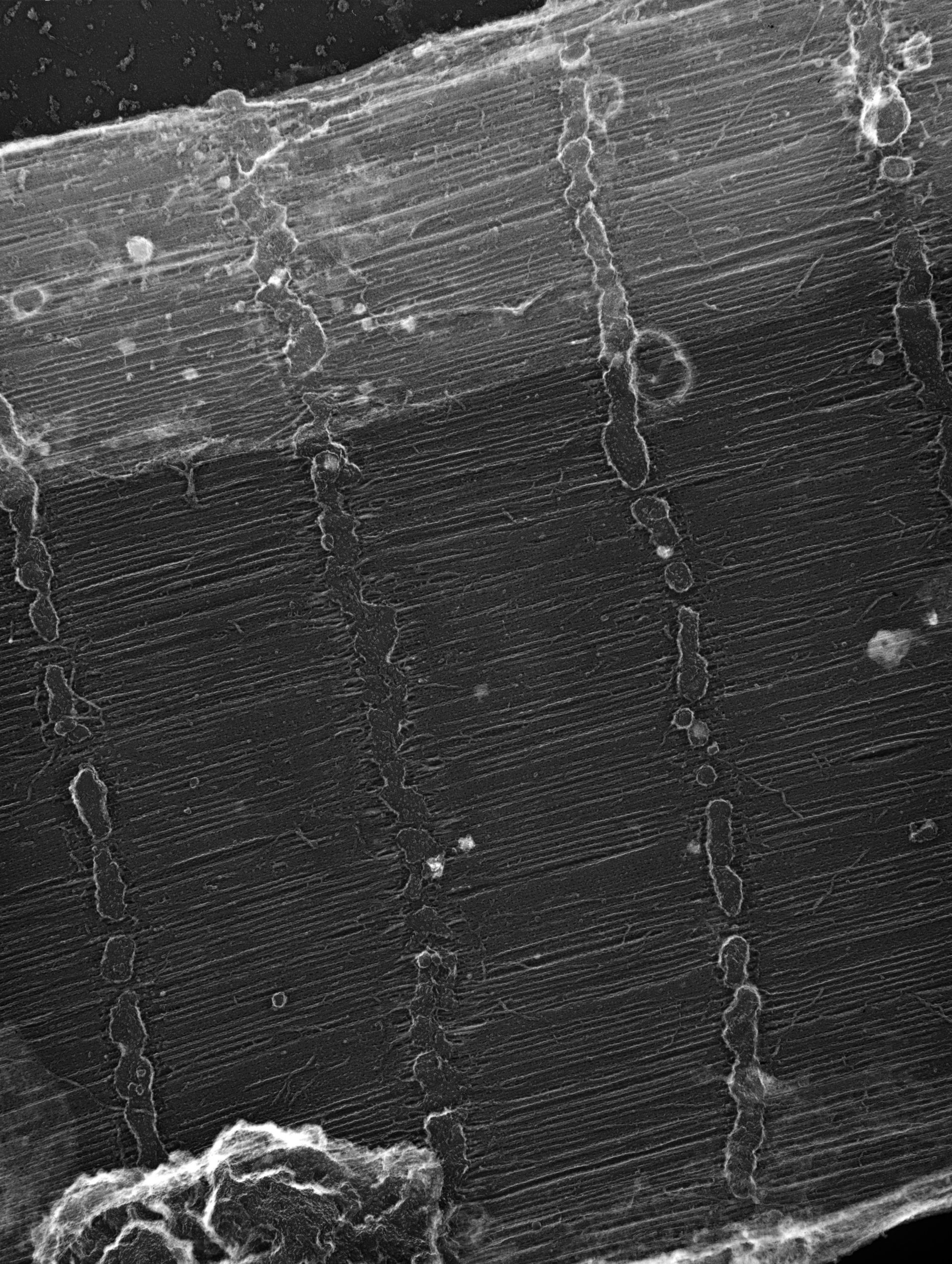 Damselfly (Sarcoplasmic reticulum) - CIL:36098