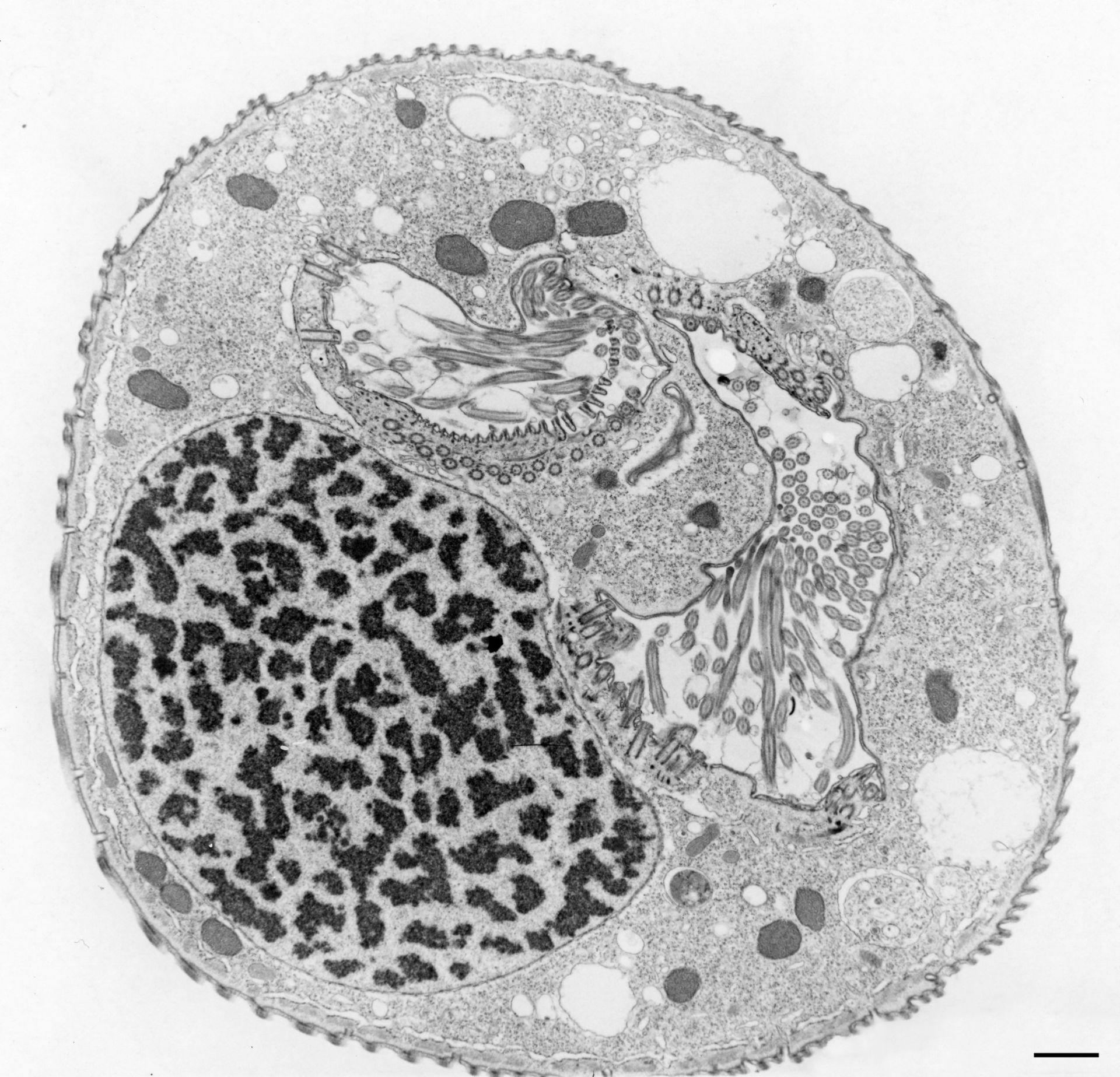 Opercularia coarctata (Cytoplasm) - CIL:9824