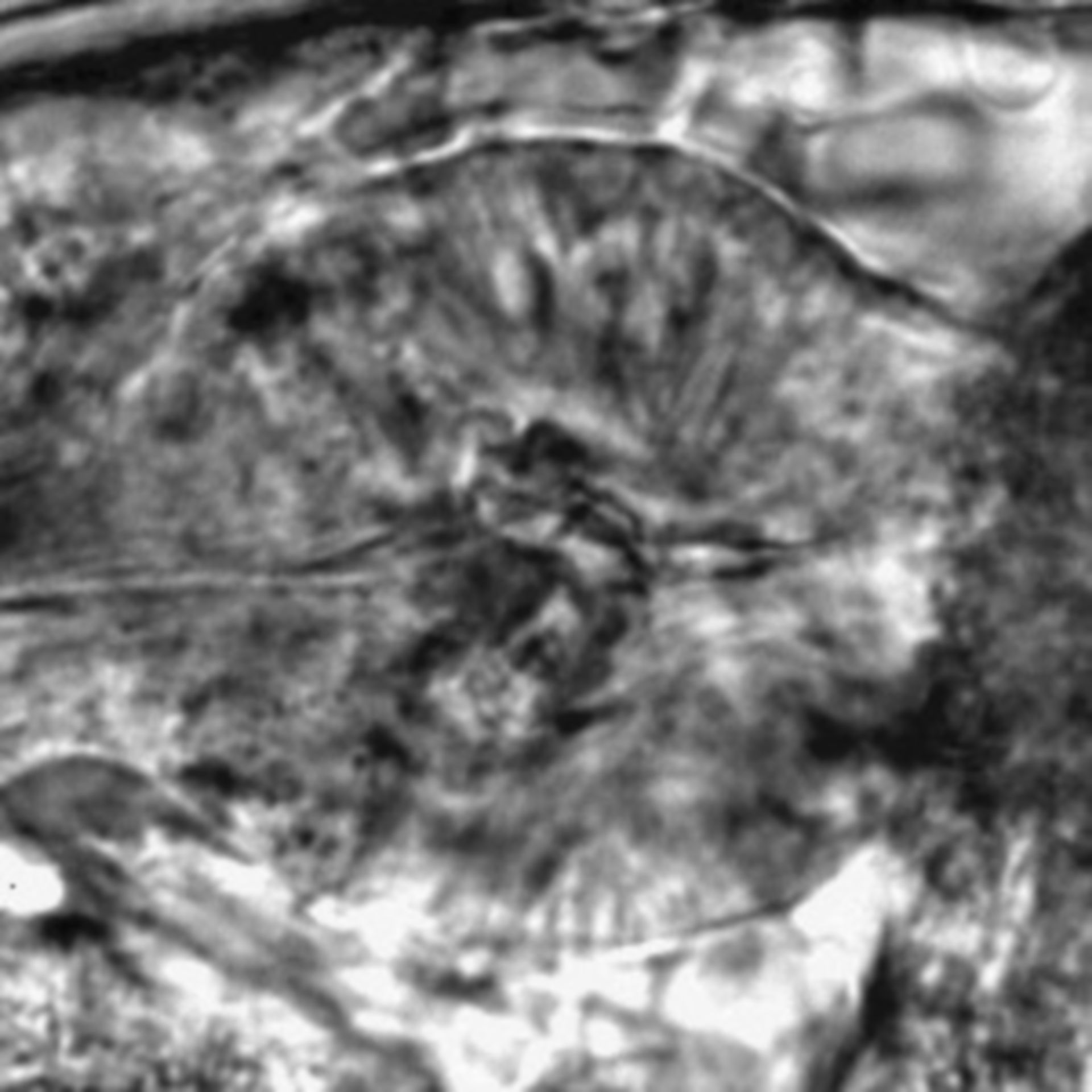 Caenorhabditis elegans - CIL:2721