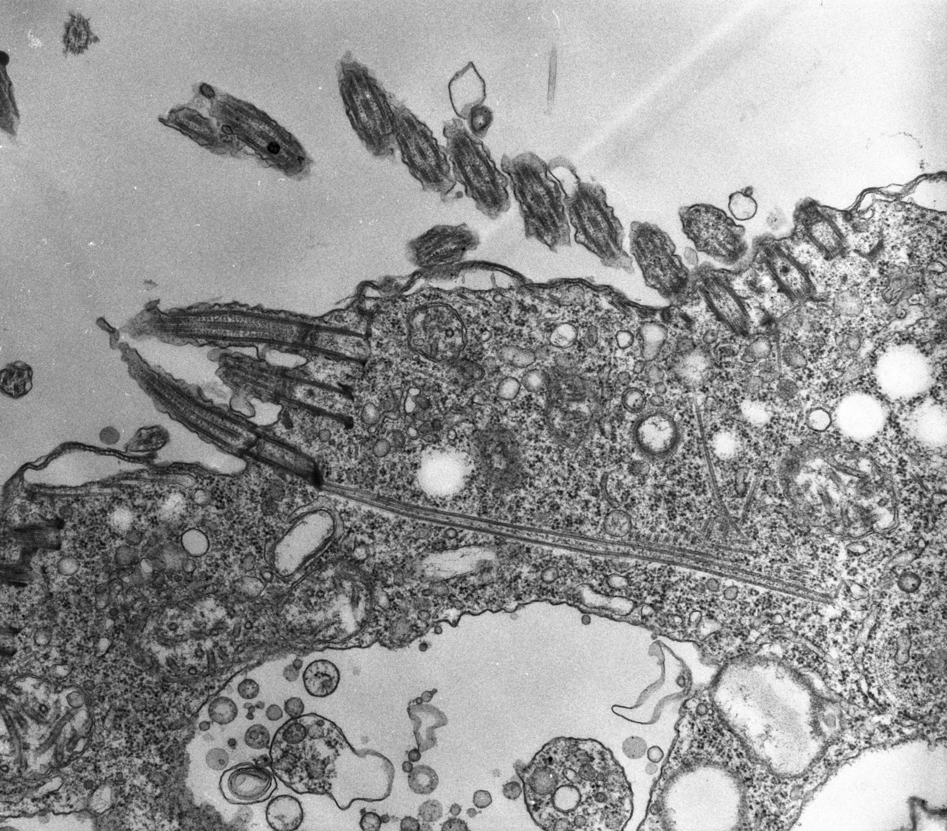 Halteria grandinella (Microtubule cytoskeleton) - CIL:7619