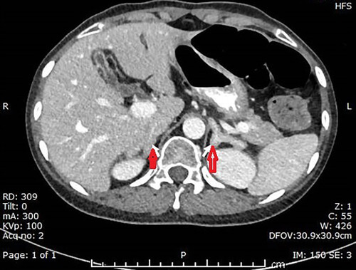 ccr34435-fig-0002-m_original.jpg