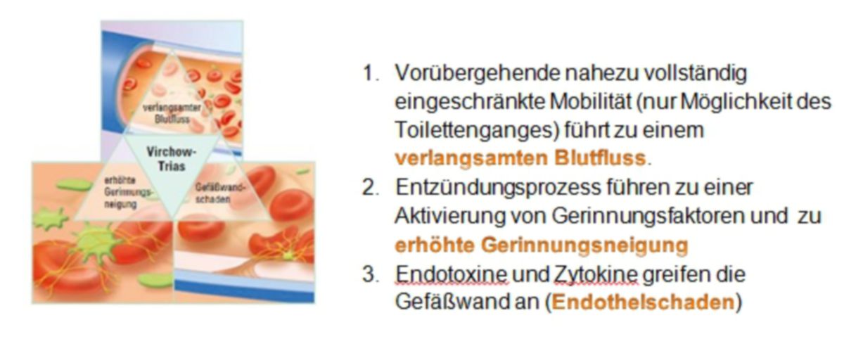 Virchow-Trias (Text) - DocCheck