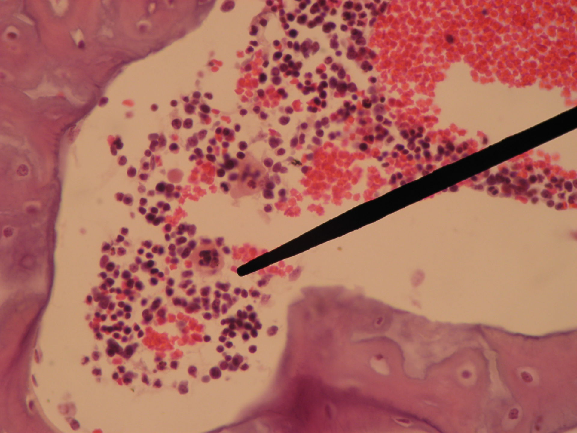 Rotes Knochenmark eines Schweinefetus (7) - Megakaryozyt