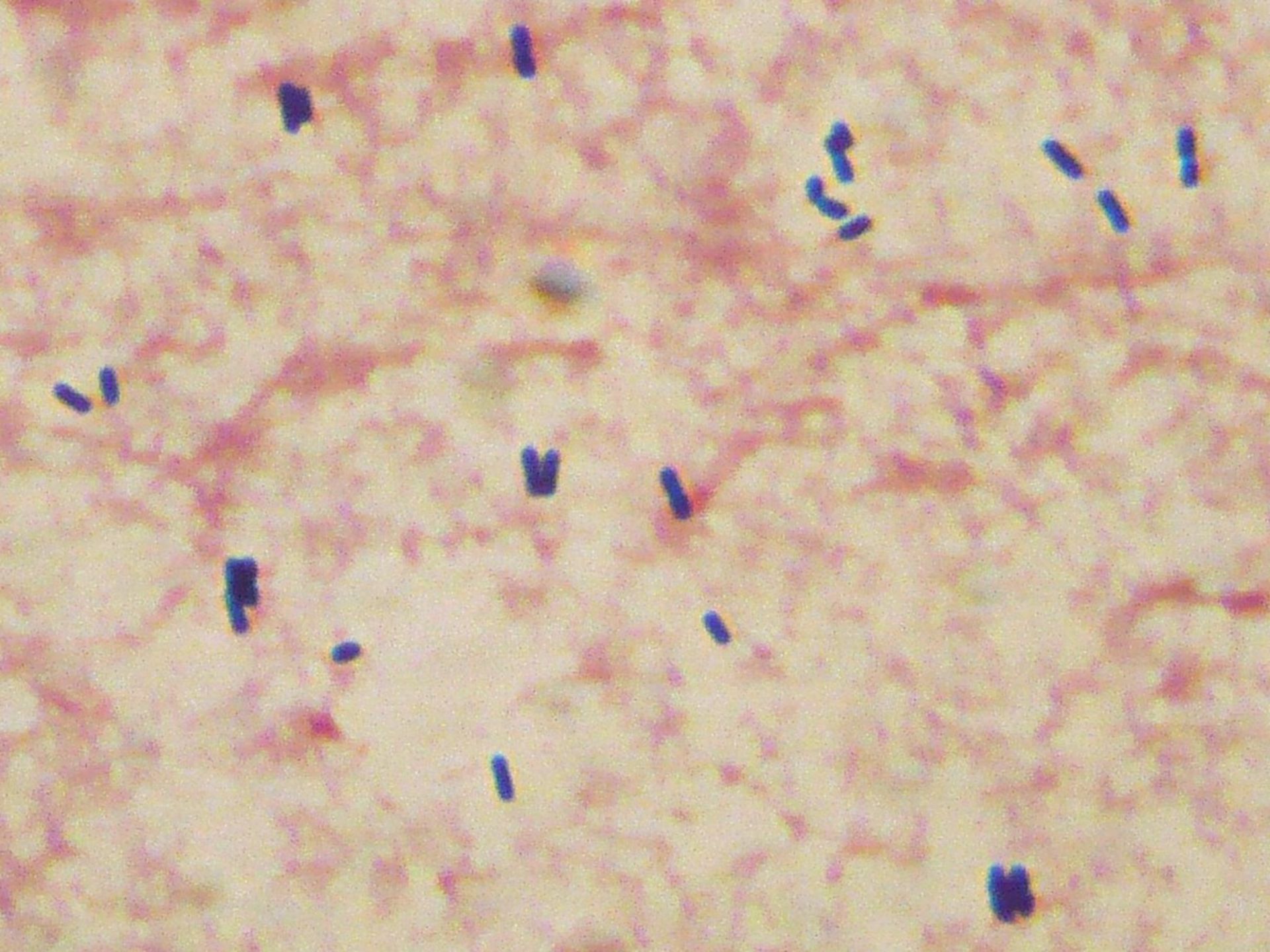 Listeria monocytogenes (Grampräparat, Liquor)