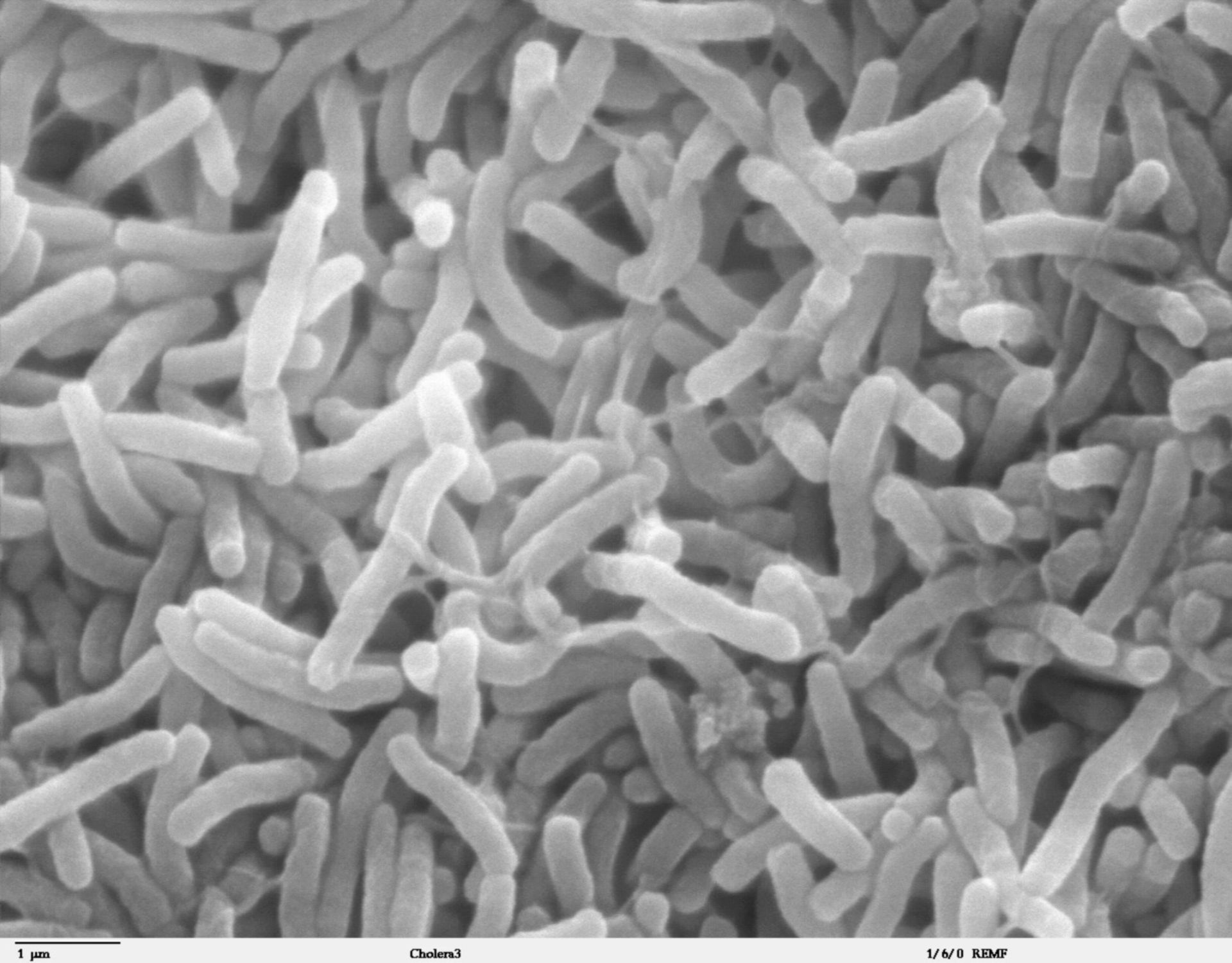 Vibrio cholerae (Cell surface) - CIL:40398