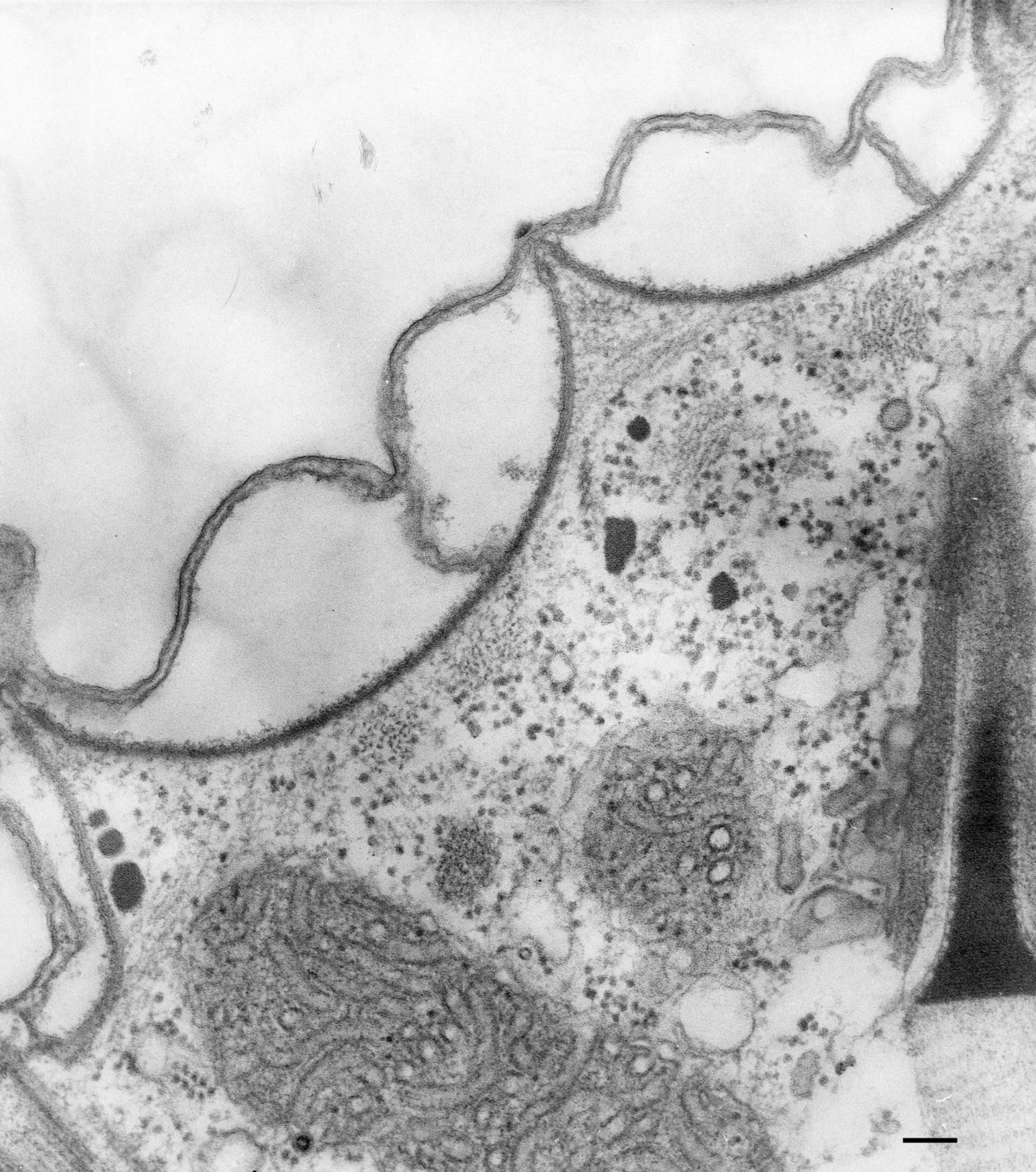 Paramecium multimicronucleatum (Cell cortex) - CIL:36599