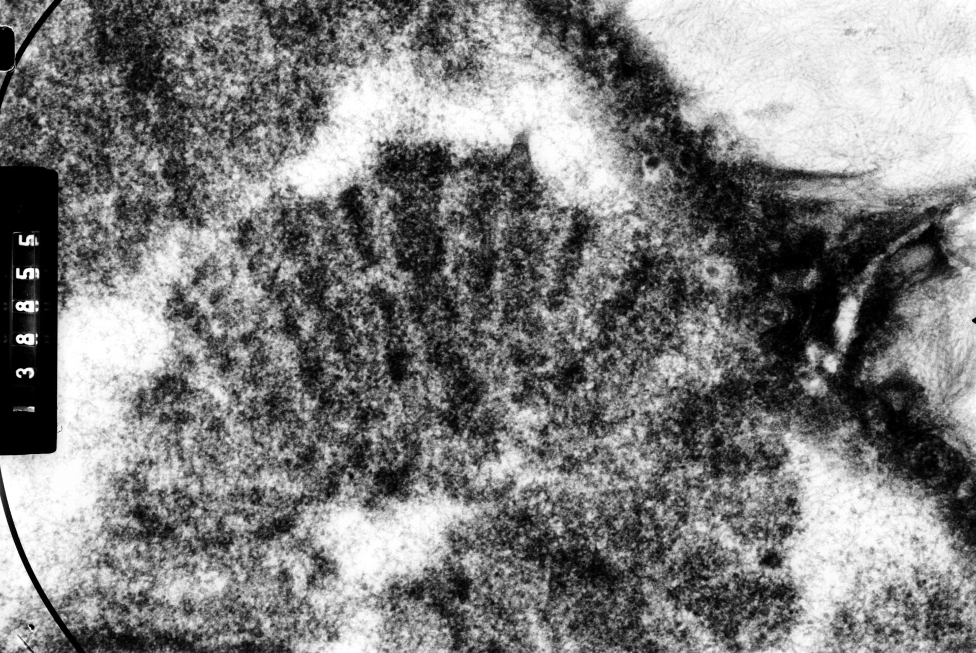 Drosophila melanocephala (Polytene chromosome) - CIL:35444