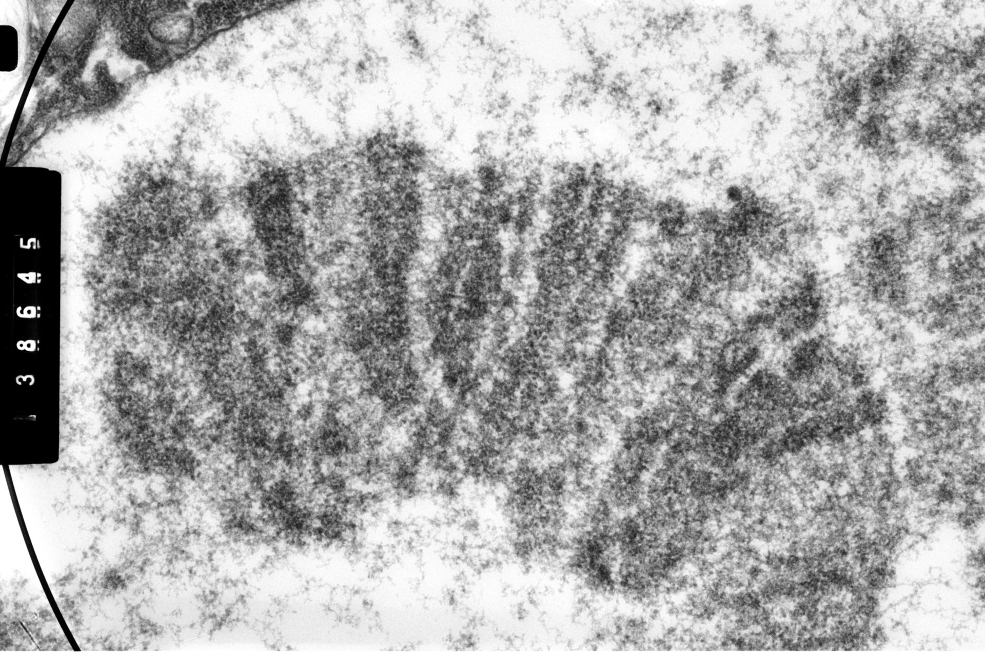 Drosophila melanogaster (Polytene chromosome) - CIL:35389