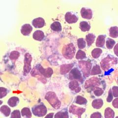 Liquorraum DocCheck Flexikon