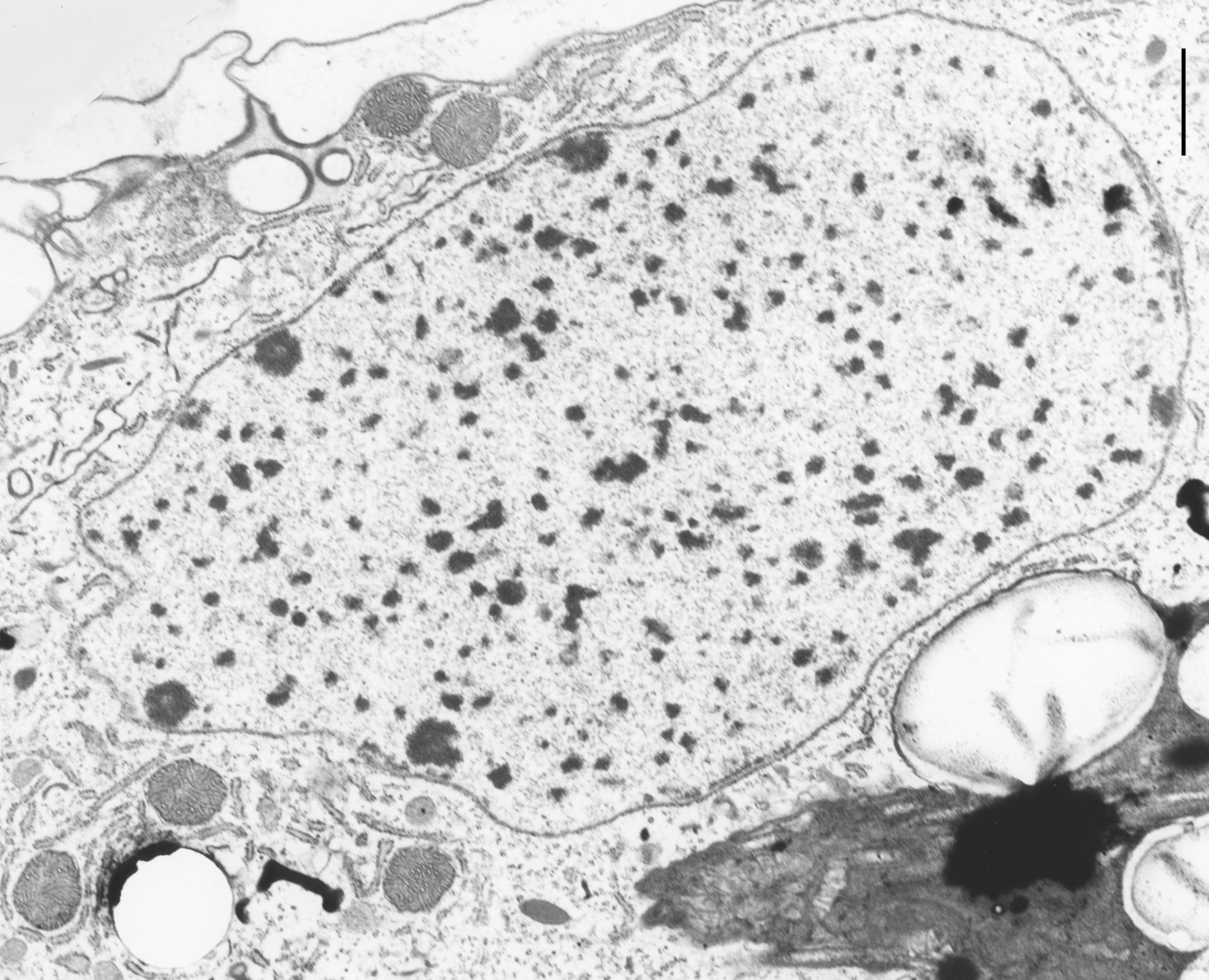 Coleps hirtus (Nucleolus) - CIL:9714