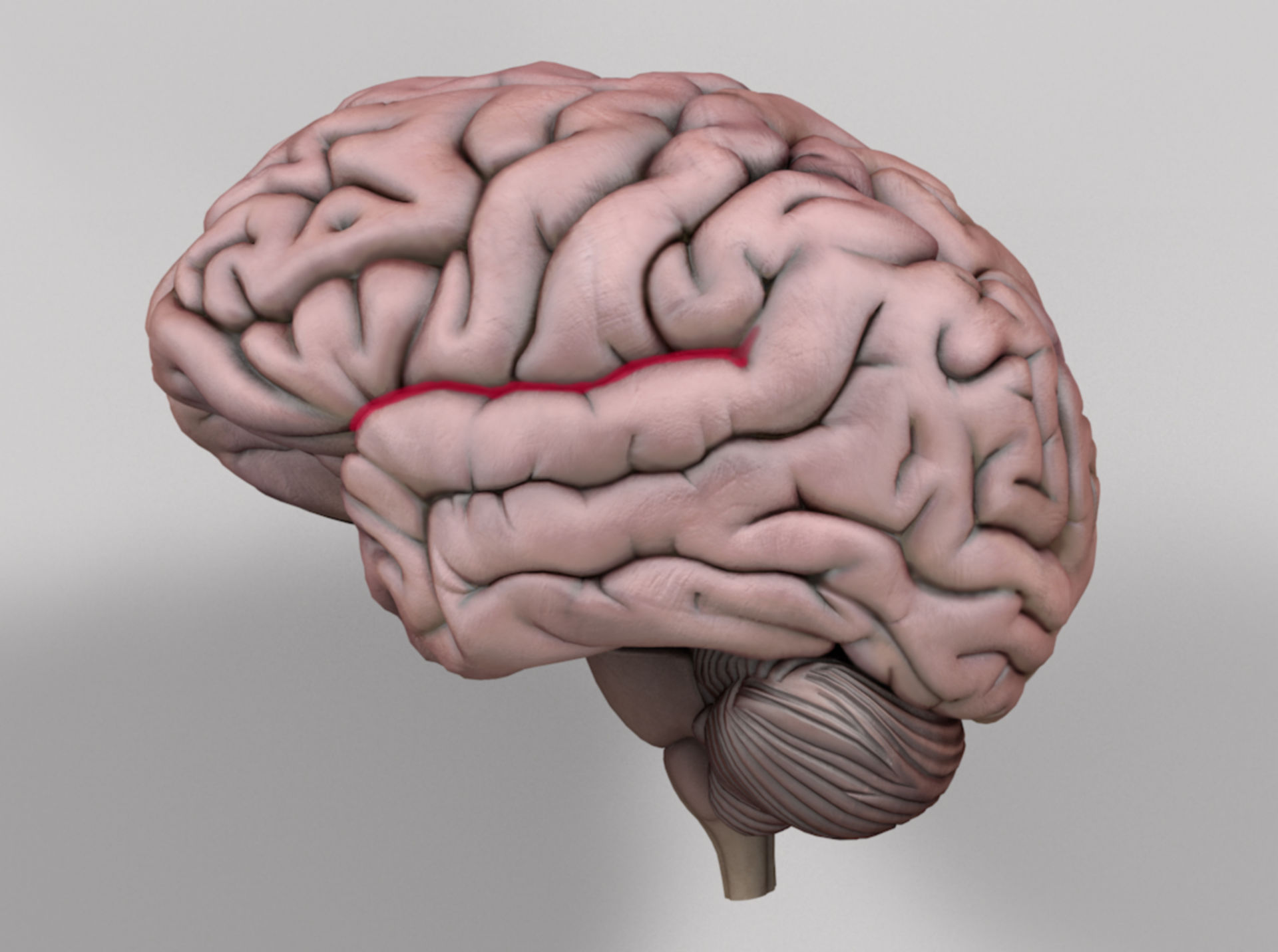 lateral-sulcus-doccheck