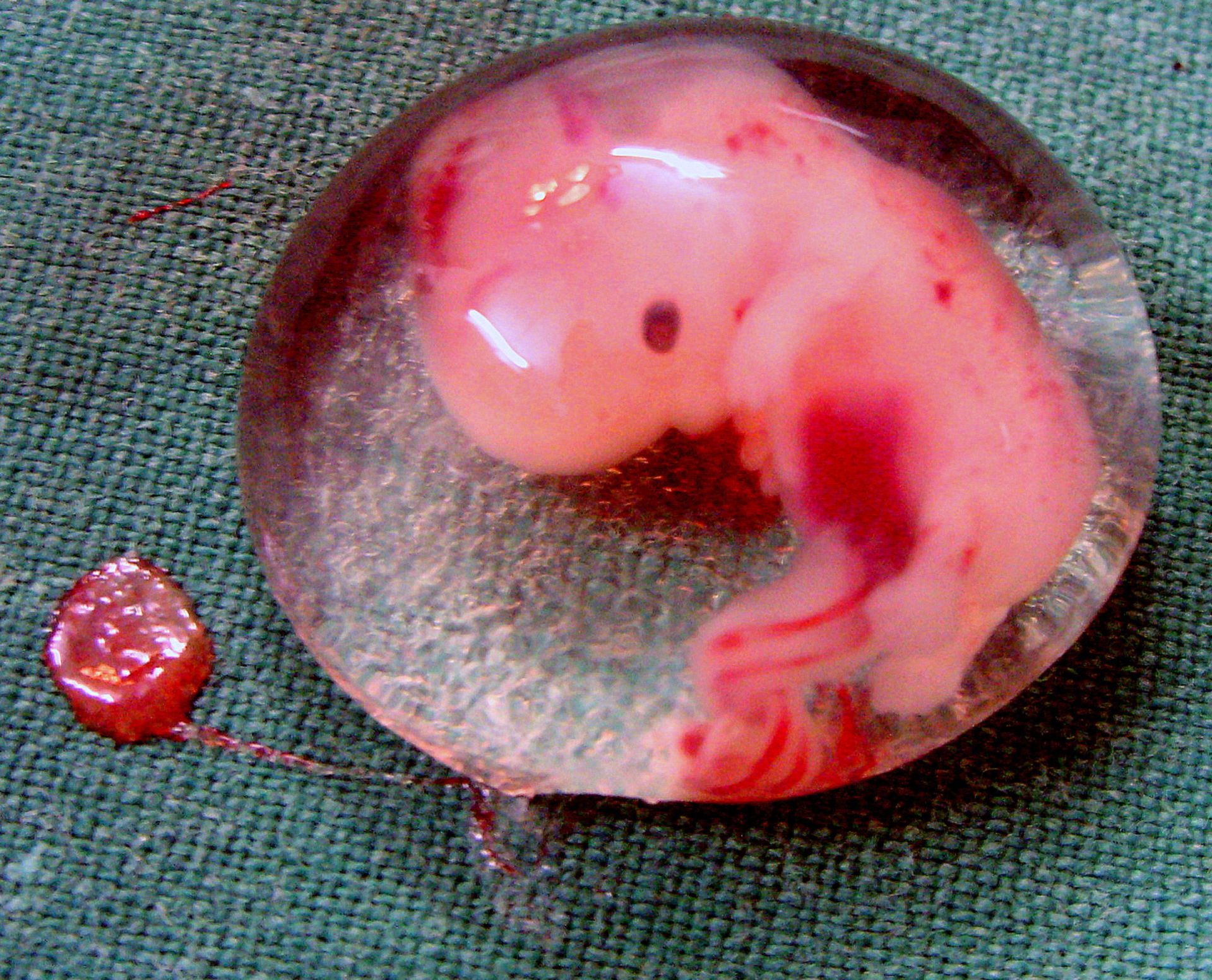 Embryo (Extrauteringravidität, 6. Woche p.c., 8. SSW)