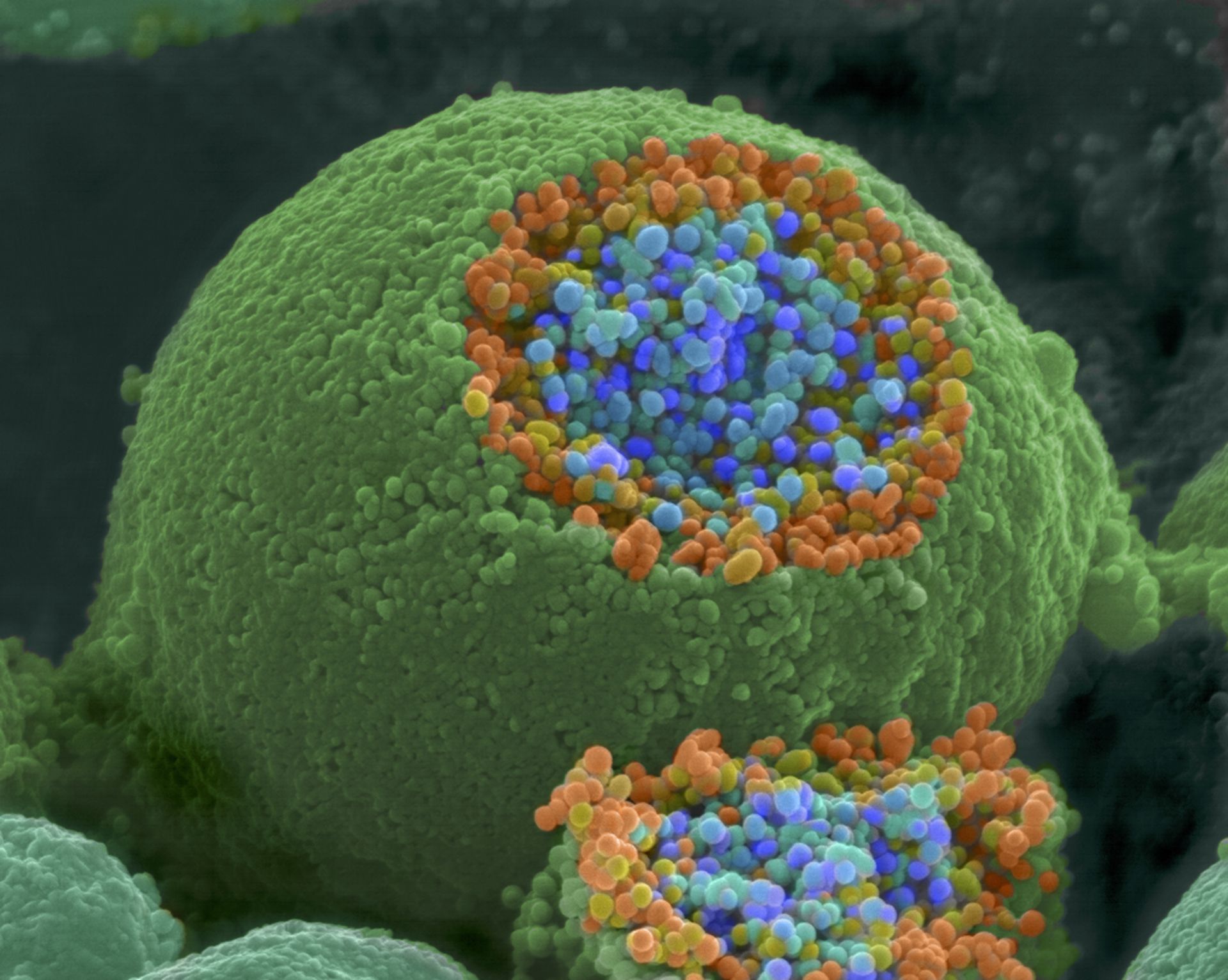 Farbiges Rasterelektronenmikroskopbild eines Nervenendes das aufgelöst worden ist, um die synaptischen Vesikel zu enthüllen