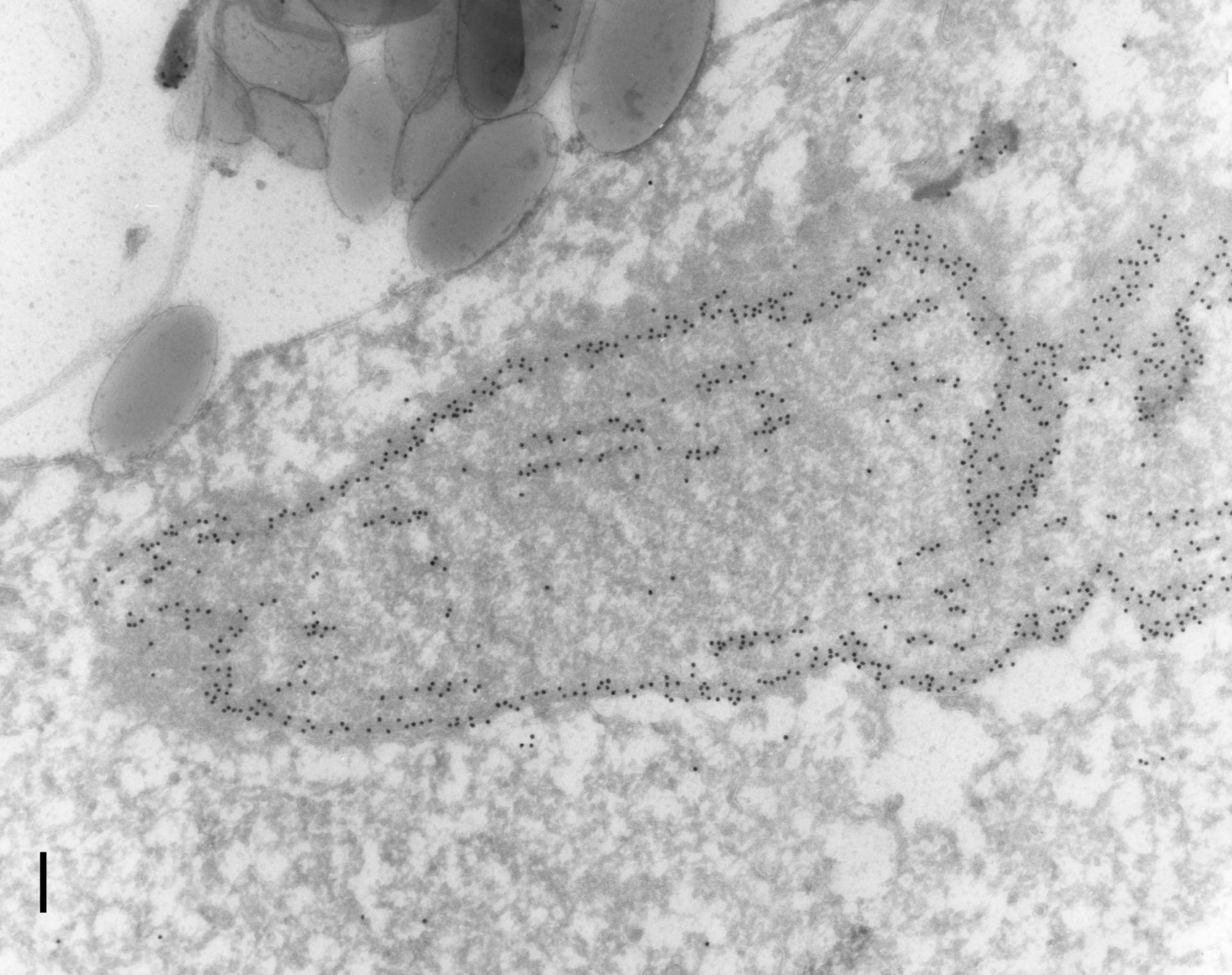 Paramecium tetraurelia (Nuclear envelope) - CIL:12090