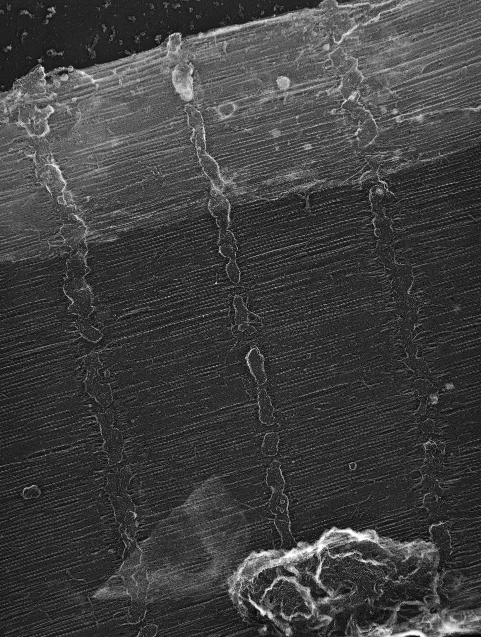 Damselfly (Sarcoplasmic reticulum) - CIL:36100