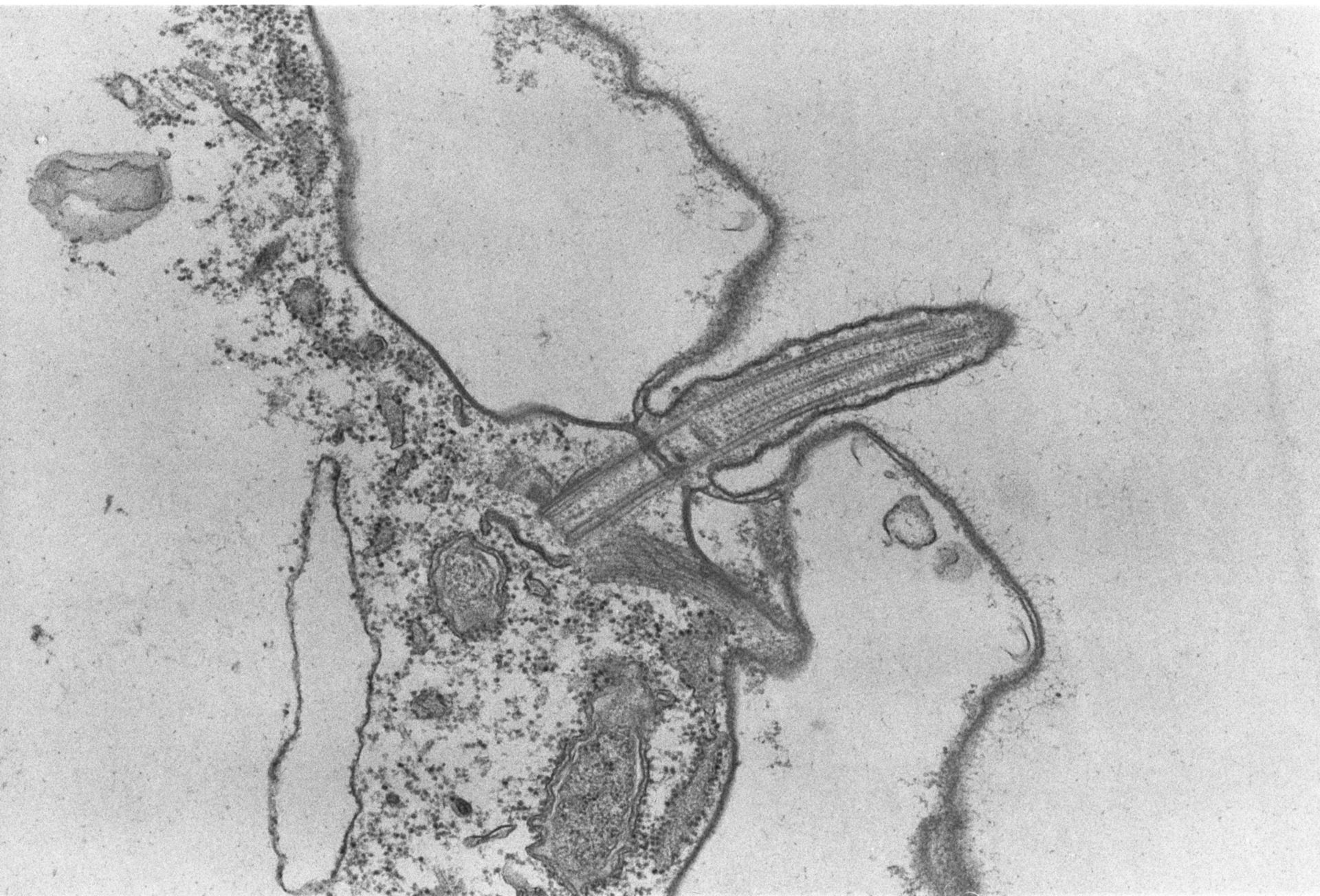 Coleps hirtus (Bacteroid-containing symbiosome) - CIL:2868