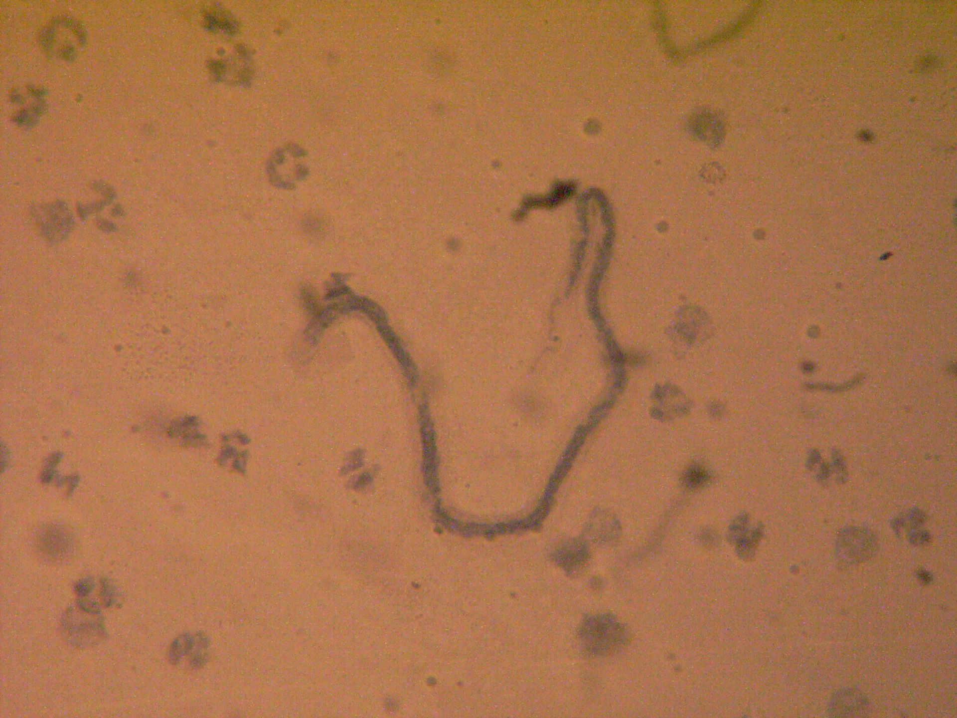 Microfilaria loaloa