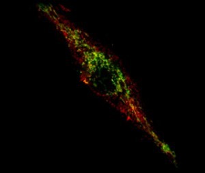 Eine Zelle, in der PINK1 fehlt. Intakte Mitochondrien (grün) und mitochondriale Antigenpräsentation (rot) © Montreal Neurological Institute and Hospital
