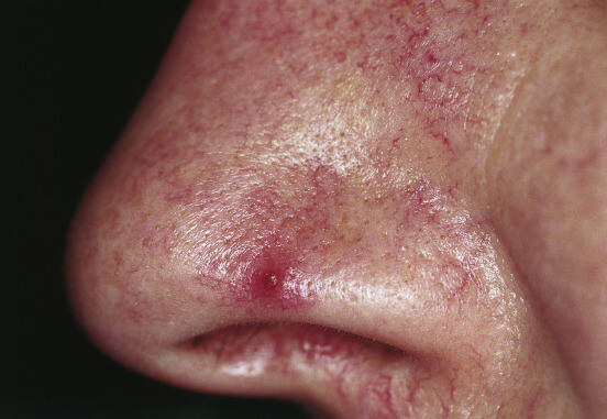 derm07_original.jpg
