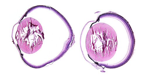 Bei Verlust des Rezeptors LRP2 verlängert sich der Augapfel (links) im Vergleich zu einem Auge mit intaktem LRP2-Rezeptor (rechts), histologische Präparate von Mäusen. © MDC